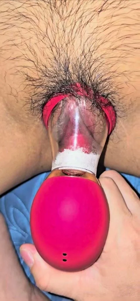 buom-non-nam-dang-buom-ra-cho-any-dung-may-de-xoa-hot-le